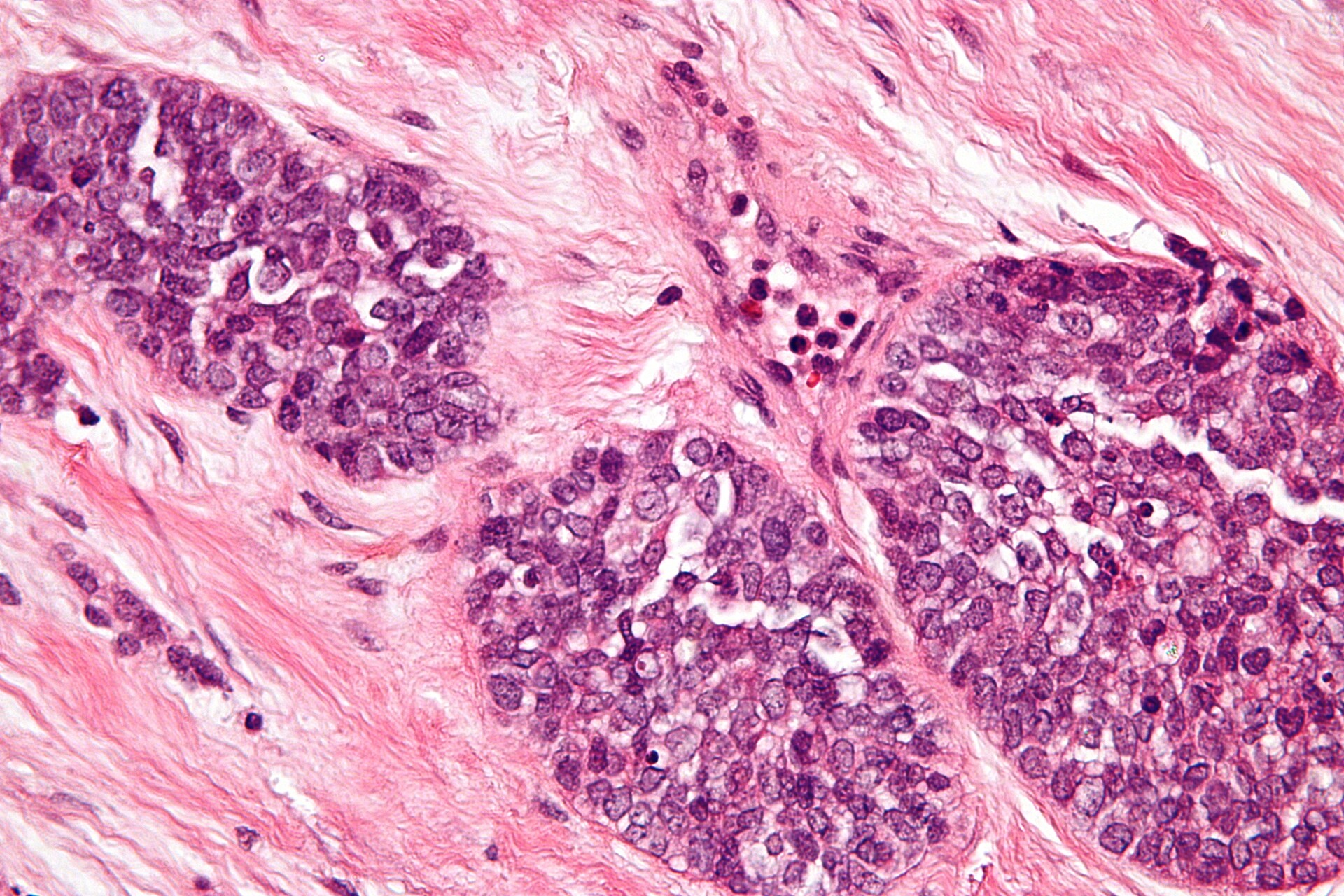New PhD research project begins in Sheffield Hospital